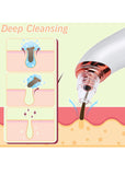 Blackhead Remover Pore Vacuum Cleaner